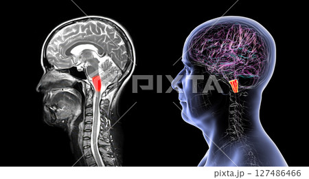 Medulla oblongata highlighted in human brain, composite colored MRI and 3D illustration. Controls breathing, heartbeat, and other vital autonomic functions 127486466