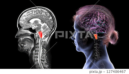 Medulla oblongata highlighted in human brain, composite colored MRI and 3D illustration. Controls breathing, heartbeat, and other vital autonomic functions 127486467