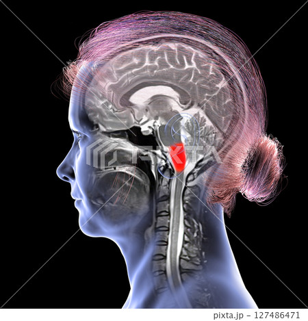 Medulla oblongata highlighted in human brain, composite colored MRI and 3D illustration. Controls breathing, heartbeat, and other vital autonomic functions 127486471