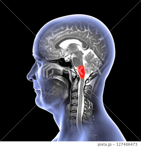 Medulla oblongata highlighted in human brain, composite colored MRI and 3D illustration. Controls breathing, heartbeat, and other vital autonomic functions 127486473