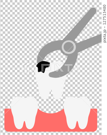 Tooth extraction "AI generated images" 127513480