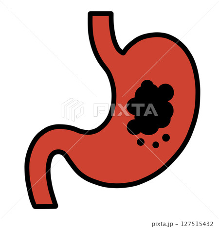 胃「AI生成画像」 127515432