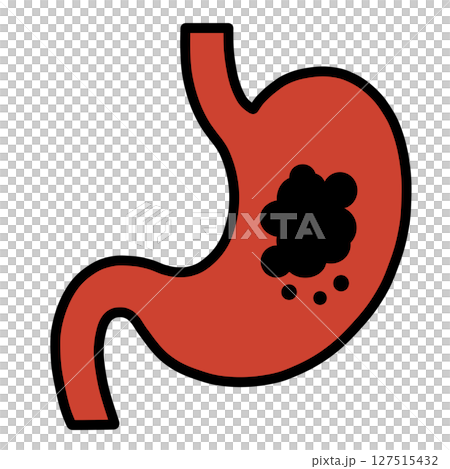胃「AI生成画像」 127515432