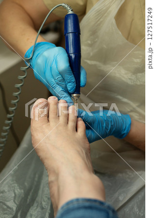 Gloved podiatrist performs dry pedicure using electric drill. 127517249