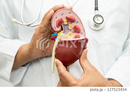 Cardiovascular disease CVD, Asian doctor holding human anatomy model for learn and treat heart disease. 127523934