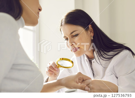 Female doctor examining hand skin of a young woman patient using magnifying glass. 127536793