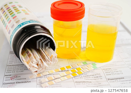 Urinalysis, urine cup for check health examination in laboratory. Urinalysis, urine cup for check health examination in laboratory. 127547658