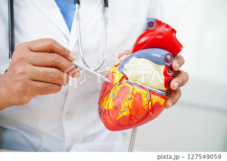Cardiovascular disease CVD, doctor with heart human model anatomy for treatment patient in hospital. Cardiovascular disease CVD, doctor with heart human model anatomy for treatment patient in hospital. 127549059