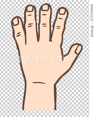 Acromegaly enlarged hands Acromegaly enlarged hands 127558404