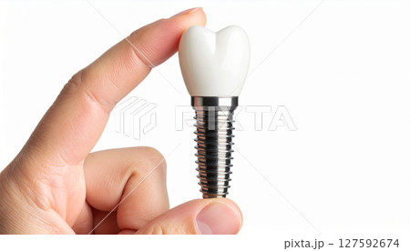 インプラントイメージ インプラントイメージ 127592674