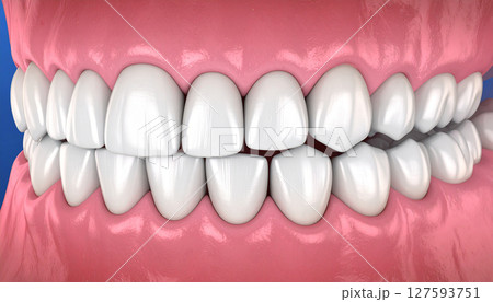 白い歯 白い歯 127593751