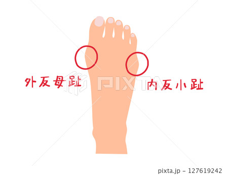 外反母趾と内反小趾の主線なしシンプルイラスト素材 外反母趾と内反小趾の主線なしシンプルイラスト素材 127619242