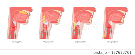 Swallowing process poster Swallowing process poster 127633761