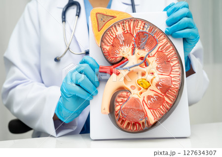 Chronic kidney disease, doctor with model for treatment urinary system, urology, Estimated glomerular filtration rate eGFR. Chronic kidney disease, doctor with model for treatment urinary system, urology, Estimated glomerular filtration rate eGFR. 127634307