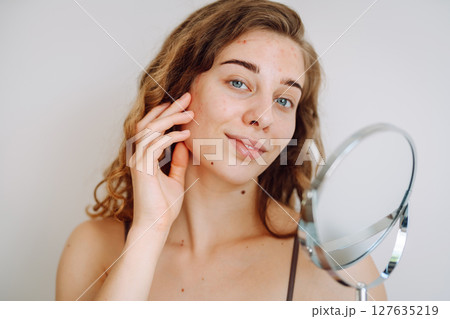 Beautiful woman with problematic skin looks in her small mirror. Cosmetology. Skin care concept. 127635219