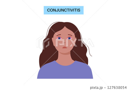Conjunctivitis medical poster 127638054