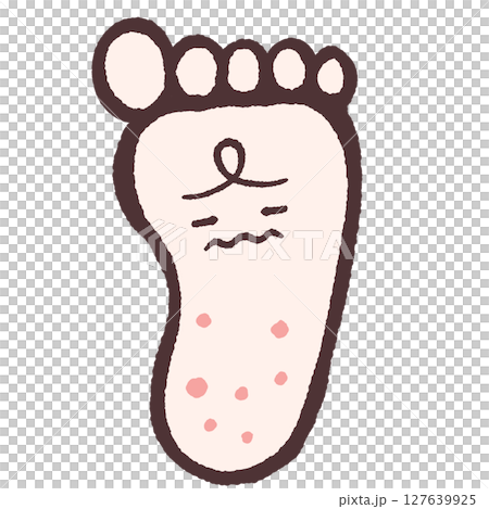 腳底濕疹的插圖 127639925