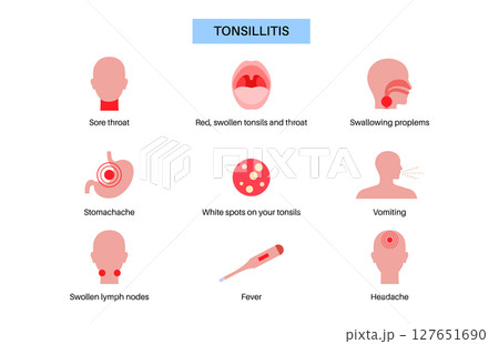 Tonsillitis Oral Desease Tonsillitis Oral Desease 127651690