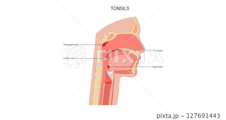 Tonsils anatomical poster Tonsils anatomical poster 127691443