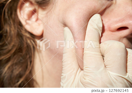 Close-up of female's cheek during skincare routine with gloved hand pressing Close-up of female's cheek during skincare routine with gloved hand pressing 127692145