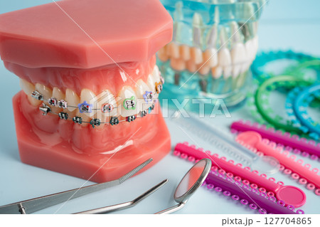 Orthodontic ligatures rings and ties, elastic rubber bands on orthodontic braces, model for dentist studying about dentistry. Orthodontic ligatures rings and ties, elastic rubber bands on orthodontic braces, model for dentist studying about dentistry. 127704865