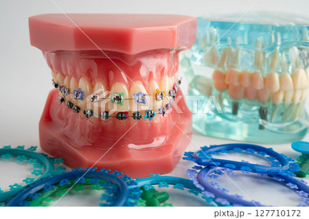 Orthodontic ligatures rings and ties, elastic rubber bands on orthodontic braces, model for dentist studying about dentistry. Orthodontic ligatures rings and ties, elastic rubber bands on orthodontic braces, model for dentist studying about dentistry. 127710172