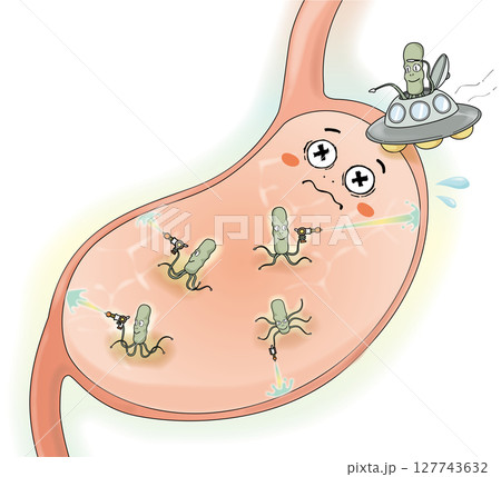 ピロリ菌に攻撃される胃 127743632
