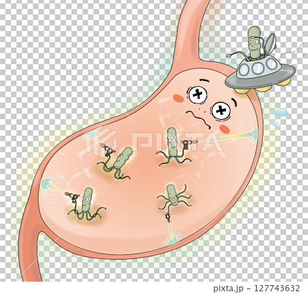 ピロリ菌に攻撃される胃 127743632