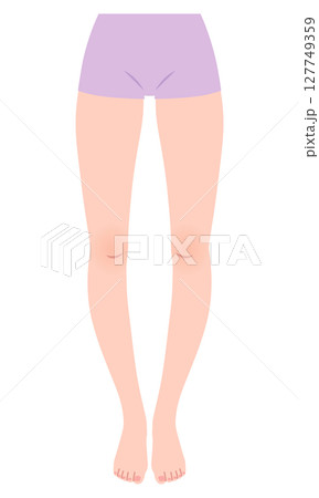 O脚　脚の歪み　O脚矯正　骨盤のゆがみ 127749359