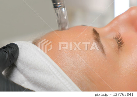Microneedle RF lifting procedure. A cosmetologist performs a facial rejuvenation procedure on a woman. Hardware cosmetology. 127763841