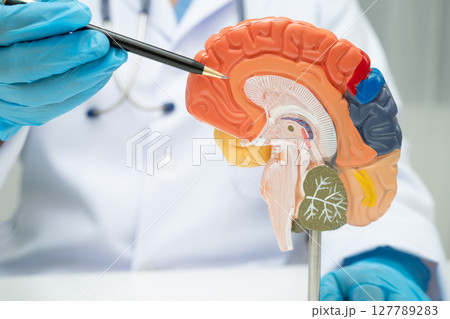 Alzheimer disease, Asian doctor holding brain anatomy model for study diagnosis and treatment in hospital. Alzheimer disease, Asian doctor holding brain anatomy model for study diagnosis and treatment in hospital. 127789283