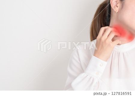 Business woman itching Neck and body scratching for Skin Allergy from insect bite and food dermatitis. Dermatology, Leprosy day, Systemic lupus erythematosus, Psoriasis, Urticaria and rash Eczema 127816591