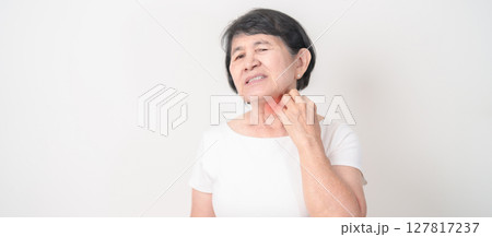 Elderly woman itching Neck and body scratching for Skin Allergy from insect bite and food dermatitis. Dermatology, Leprosy day, Systemic lupus erythematosus, Psoriasis, Urticaria and rash Eczema 127817237