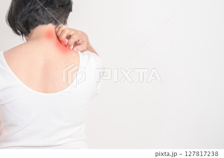 Elderly woman itching Neck and body scratching for Skin Allergy from insect bite and food dermatitis. Dermatology, Leprosy day, Systemic lupus erythematosus, Psoriasis, Urticaria and rash Eczema 127817238