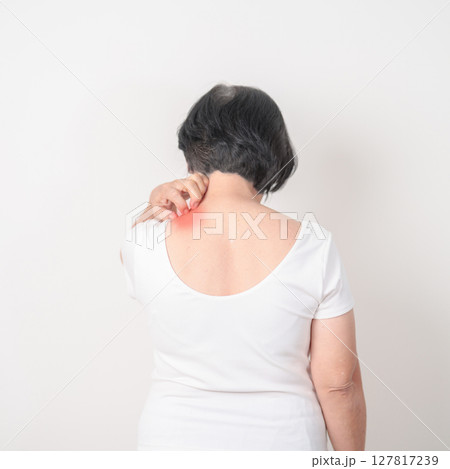 Elderly woman itching Neck and body scratching for Skin Allergy from insect bite and food dermatitis. Dermatology, Leprosy day, Systemic lupus erythematosus, Psoriasis, Urticaria and rash Eczema Elderly woman itching Neck and body scratching for Skin Allergy from insect bite and food dermatitis. Dermatology, Leprosy day, Systemic lupus erythematosus, Psoriasis, Urticaria and rash Eczema 127817239