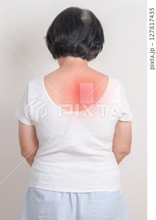 Business woman having back ache with Medicated pain relief patch plaster for Back Muscle Strain, Scapular Muscle Tightness, Piriformis Syndrome, Osteoporosis, Spinal Compression and Health care 127817435