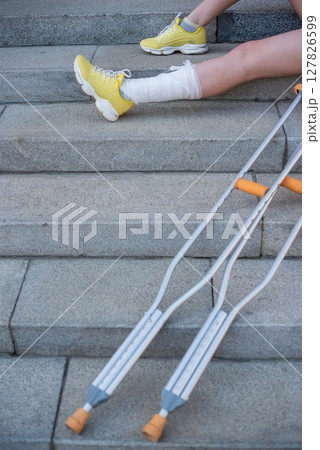 Girl with leg injury sits on the stairs with crutches. Girl with leg injury sits on the stairs with crutches. 127826599