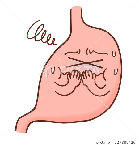 気分が悪い胃(カラー) 気分が悪い胃(カラー) 127889426
