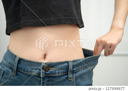 Young Asian woman losing weight wearing loose pants in oversize jeans. 127899877
