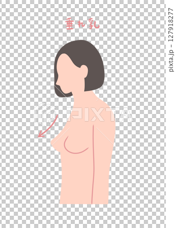 乳房下垂的女性的側面插圖 乳房下垂的女性的側面插圖 127918277