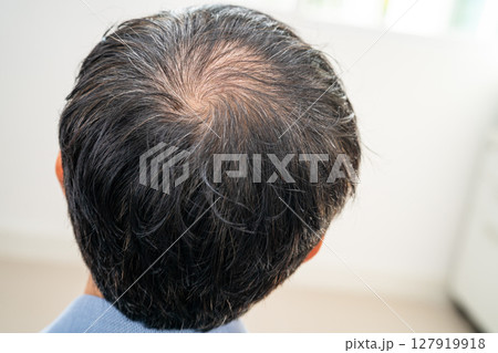 Bald in the middle head and begin no loss hair glabrous of mature Asian business smart active office man. 127919918