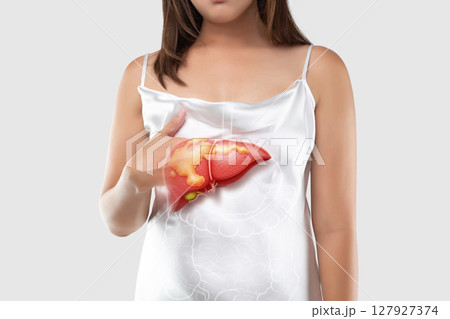 Fatty liver disease: Understand symptoms, seek care. 127927374