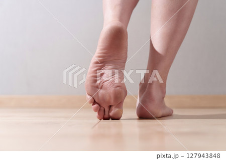 Woman's feet with dry and damaged heels, indicating urgent need for effective foot care and moisture therapy Woman's feet with dry and damaged heels, indicating urgent need for effective foot care and moisture therapy 127943848