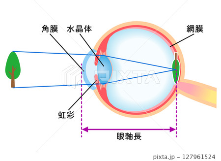 目の構造 正視の屈折 目の構造 正視の屈折 127961524