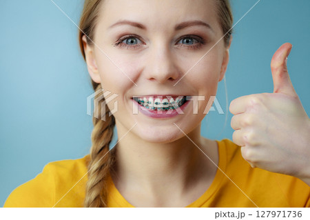 Young woman showing teeth braces 127971736