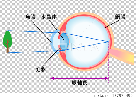 Structure of the eye: Refraction of normal vision 127973490