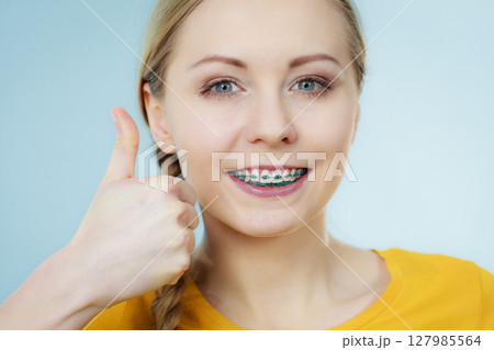 Young woman showing teeth braces Young woman showing teeth braces 127985564