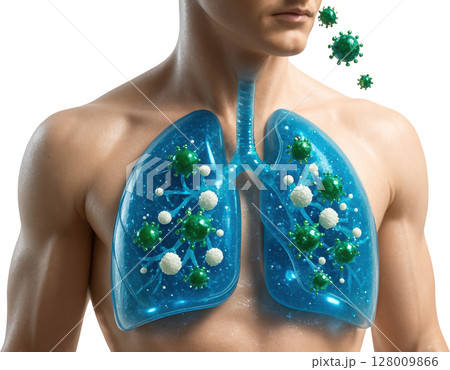 Human lungs with viral infection and immune response Human lungs with viral infection and immune response 128009866