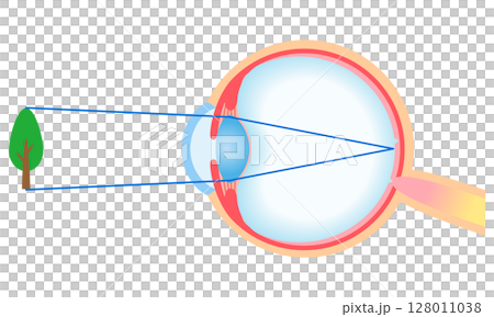 Structure of the eye: Refraction of normal vision 128011038