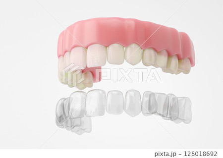 マウスピース矯正のイメージ 綺麗な歯並びの審美歯科3DCG 128018692